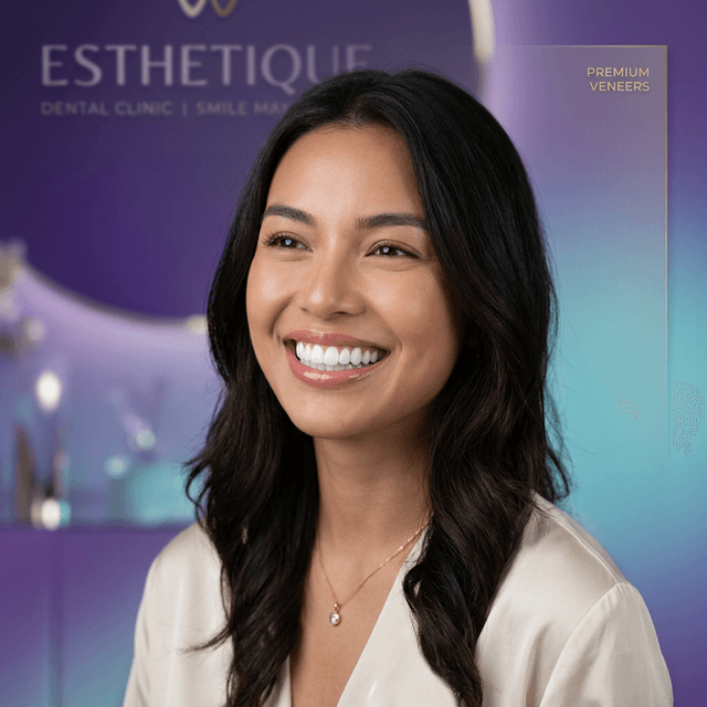 ابتسامة هوليوود